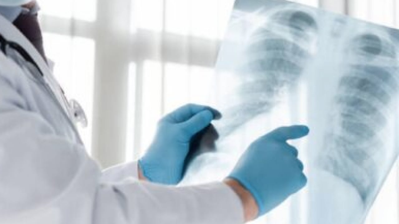 Göğüs hastalıkları hekiminden pulmoner rehabilitasyon çağrısı