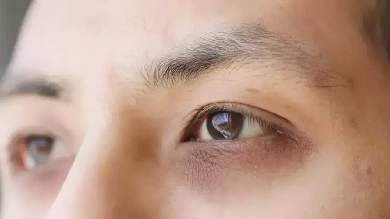 Foto - Göz altı morluklarına sır gibi saklanan mucizevi çözüm: Bebek gibi cildin sırrı! Kolejen etkisini birçok kişi bilmiyor