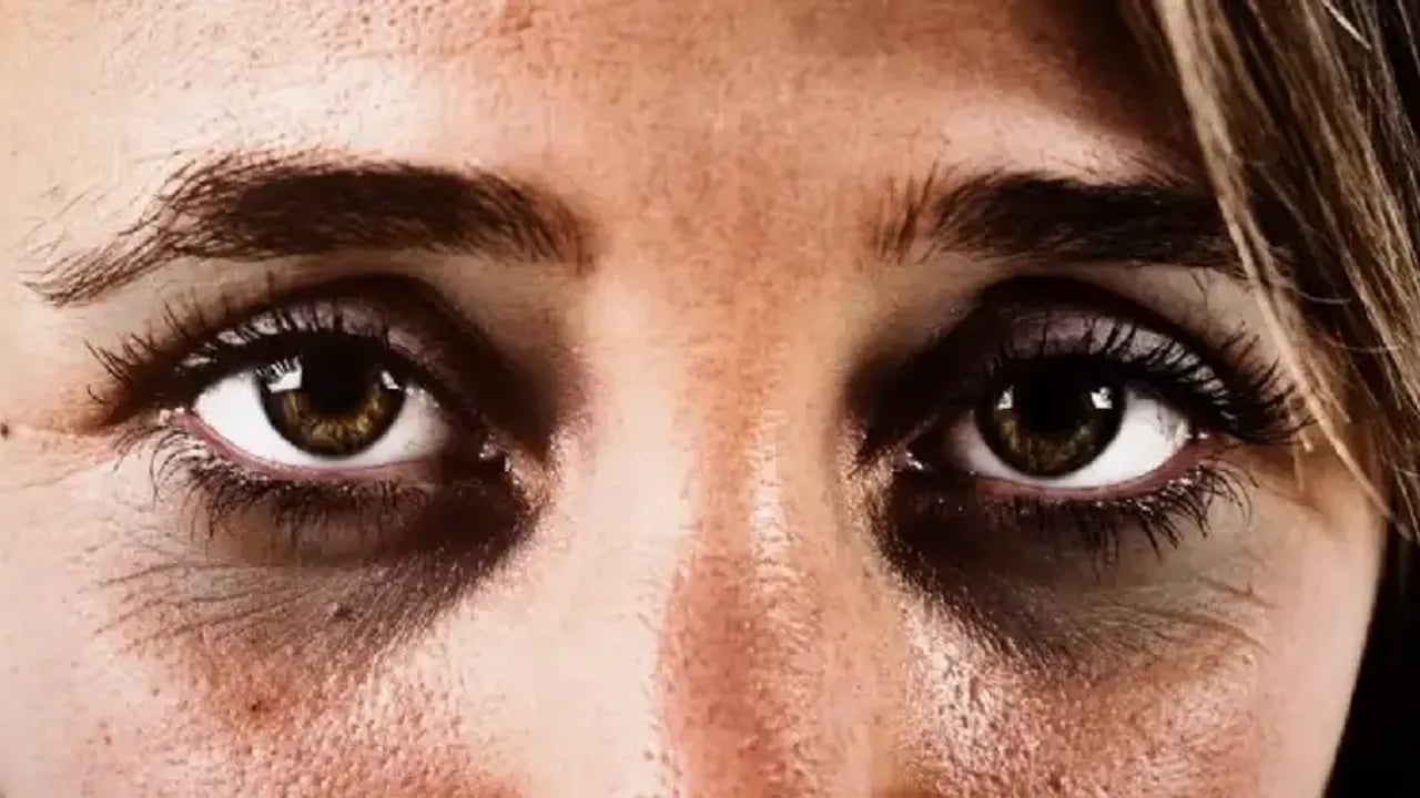 Foto - Göz altı morluklarına sır gibi saklanan mucizevi çözüm: Bebek gibi cildin sırrı! Kolejen etkisini birçok kişi bilmiyor