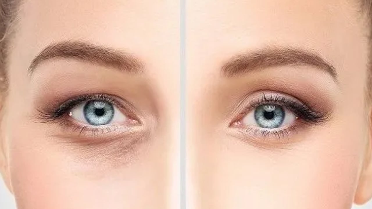 Foto - Göz altı morluklarına ürünleri alırken dikkat! Uzmanlar uyarıyor