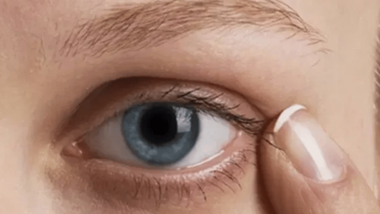 Foto - Gözde kaşıntıyı hafife almayın! Bu hastalığın habercisi olabilir