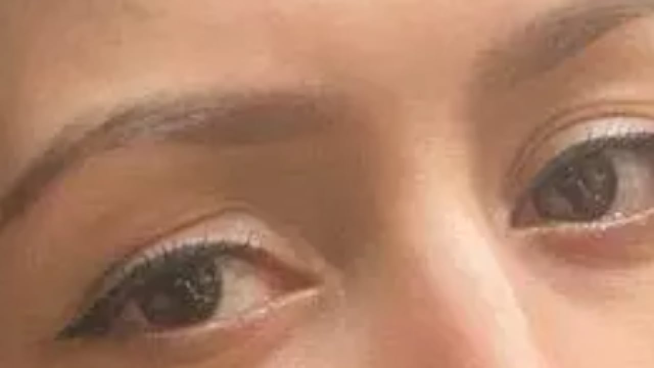 Foto - Gözlerinde kalıcı hasar oluştu! Mahkemeden gelen karar şok etti!