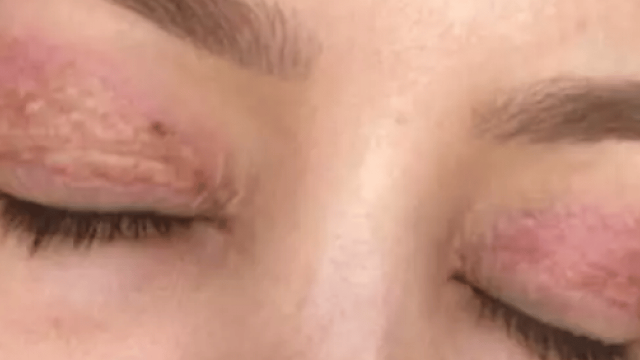 Foto - Gözlerinde kalıcı hasar oluştu! Mahkemeden gelen karar şok etti!