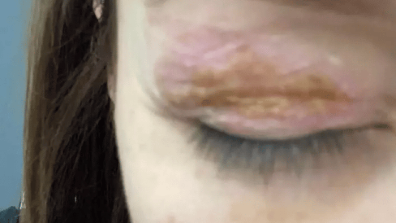 Foto - Gözlerinde kalıcı hasar oluştu! Mahkemeden gelen karar şok etti!