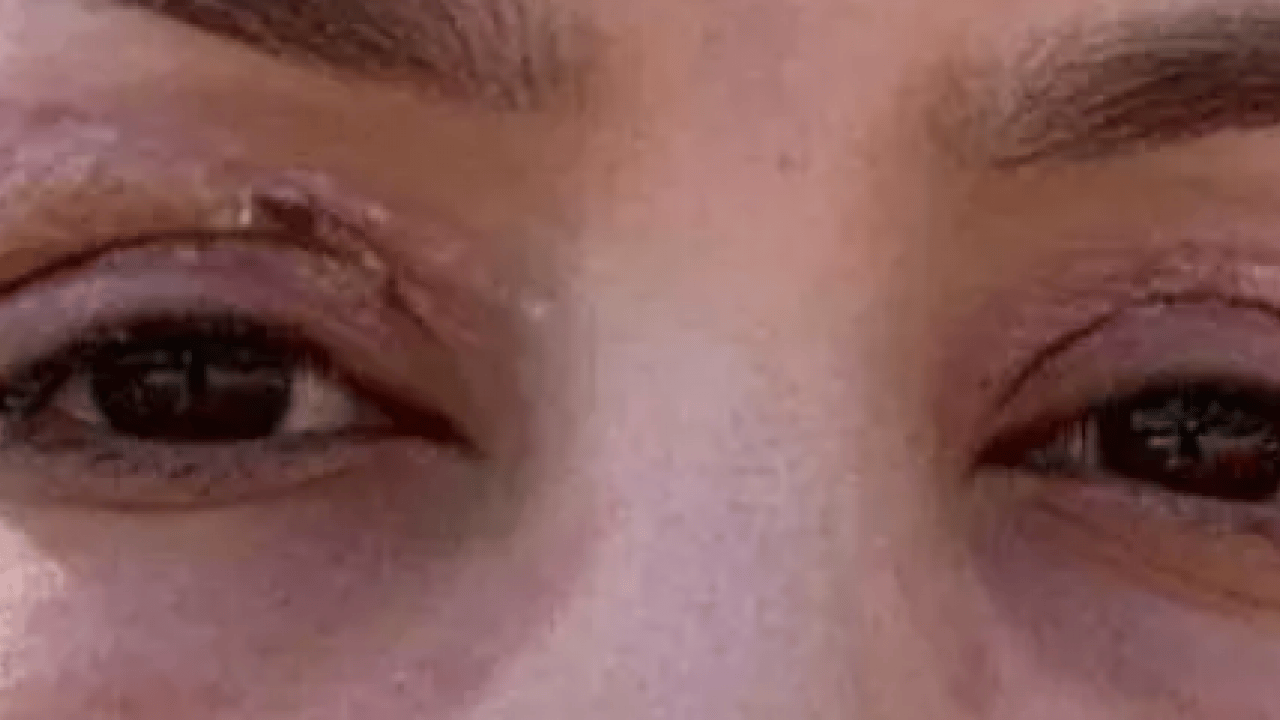 Foto - Gözlerinde kalıcı hasar oluştu! Mahkemeden gelen karar şok etti!