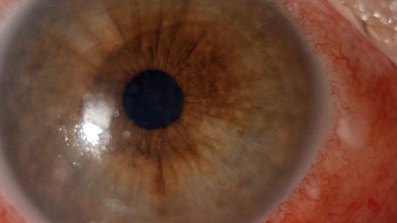 Foto - Gözlerine suyunu damlattı, göremez hale geldi... Kötü haber geldi! Tamamen tahrip ediyor...