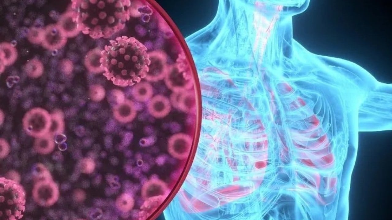 Foto - Gözlerinizi açtığınızda vücudunuz size bu sinyali veriyor olabilir! Akciğer kanserinin sabahları fark edilen o gizli işareti ortaya çıktı!