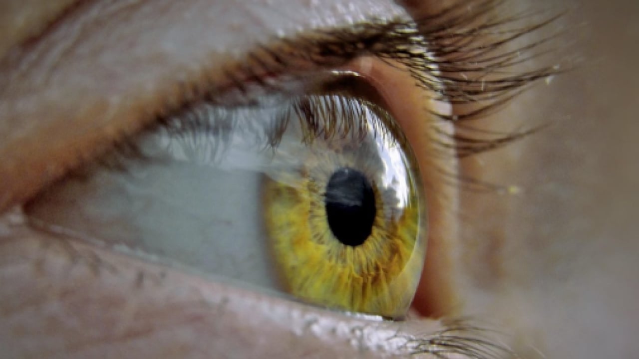 Foto - Gözün ‘sessiz hırsızı’ Glokom: Fark ettiğinizde çok geç olabilir