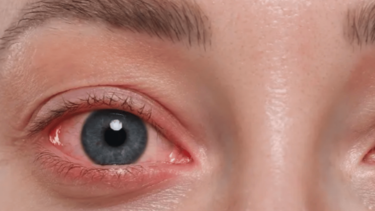 Gözünüz ne kadar sağlıklı? Doğru yaşam tarzı ile göz sağlığını korumak elimizde: 3 kuralı