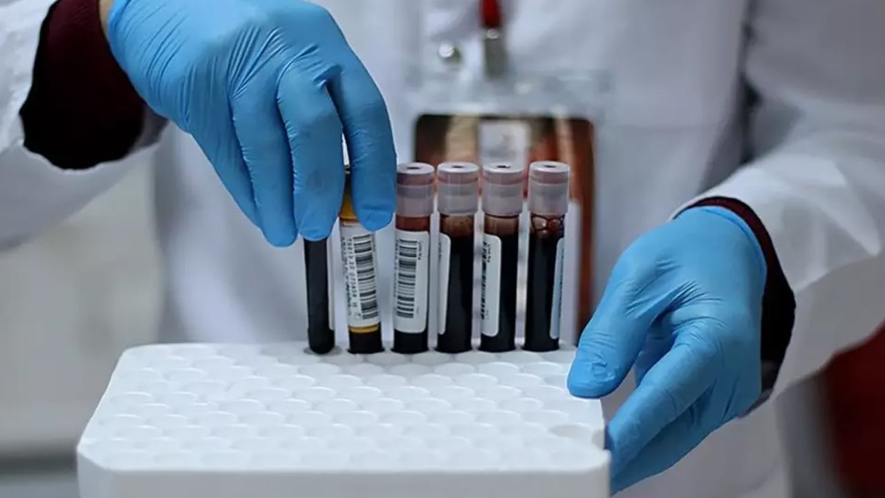 Foto - Bağışıklık mı, yoksa kan grubu mu, dikkate alınmalı?