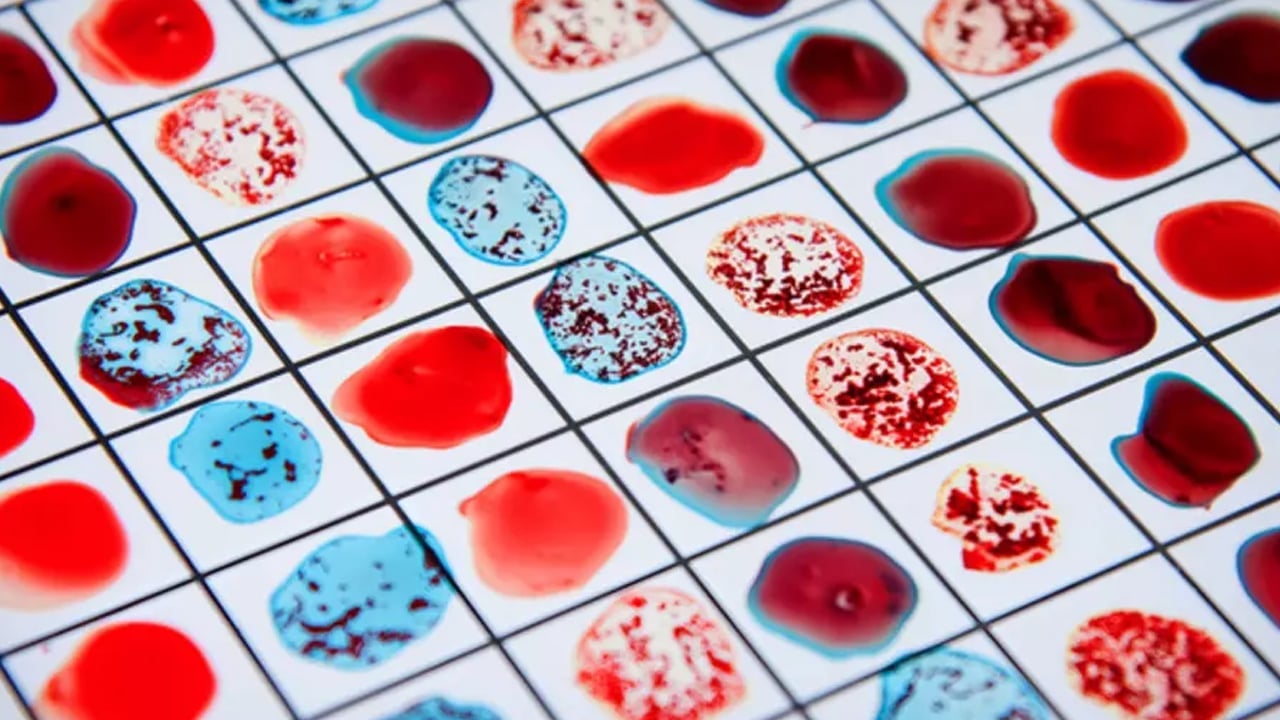 Foto - Bağışıklık mı, yoksa kan grubu mu, dikkate alınmalı?