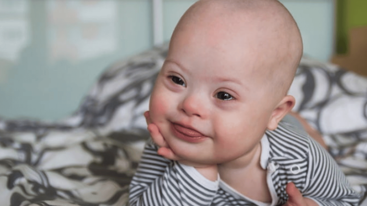 Foto - Güncel epidemiyolojik verilere dikkat: Otizim spektrum bozukluğu her 31 çocuktan 1'inde görülmektedir