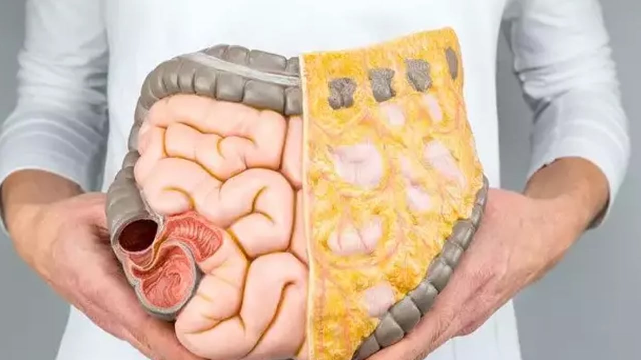 Foto - Halk arasında 'Meyvelerin Kralı' olarak biliniyor: Durian yetiştiriciliğinde çok önemli çalışma! Kokusu çok kötü