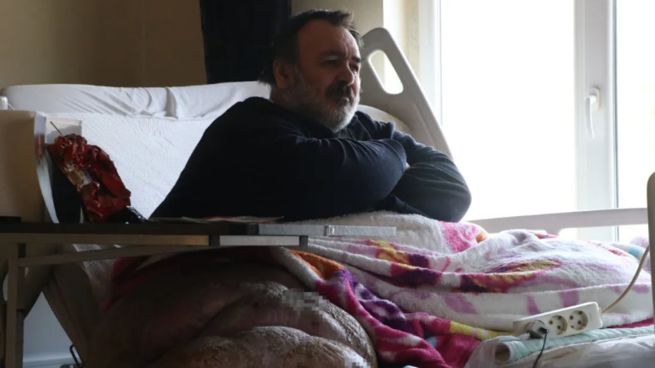 Foto - Hastalığı hayatını kararttı: 5 yıldır evden çıkamıyor!