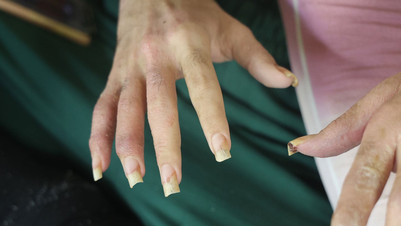 Foto - Hatay’da yürek burkan hikaye! 3 yıldır evden çıkmıyor sadece telefonla yaşıyor