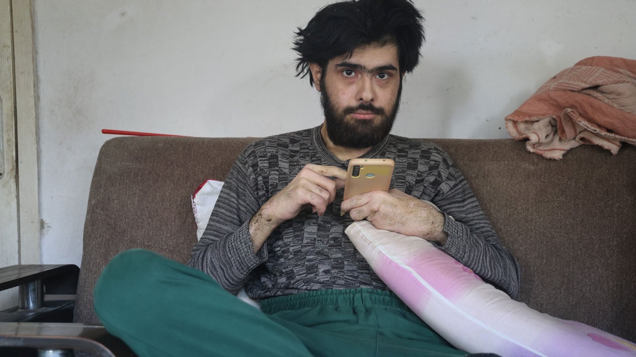 Hatay’da yürek burkan hikaye! 3 yıldır evden çıkmıyor sadece telefonla yaşıyor