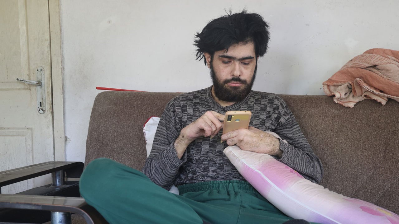 Foto - Hatay’da yürek burkan hikaye! 3 yıldır evden çıkmıyor sadece telefonla yaşıyor