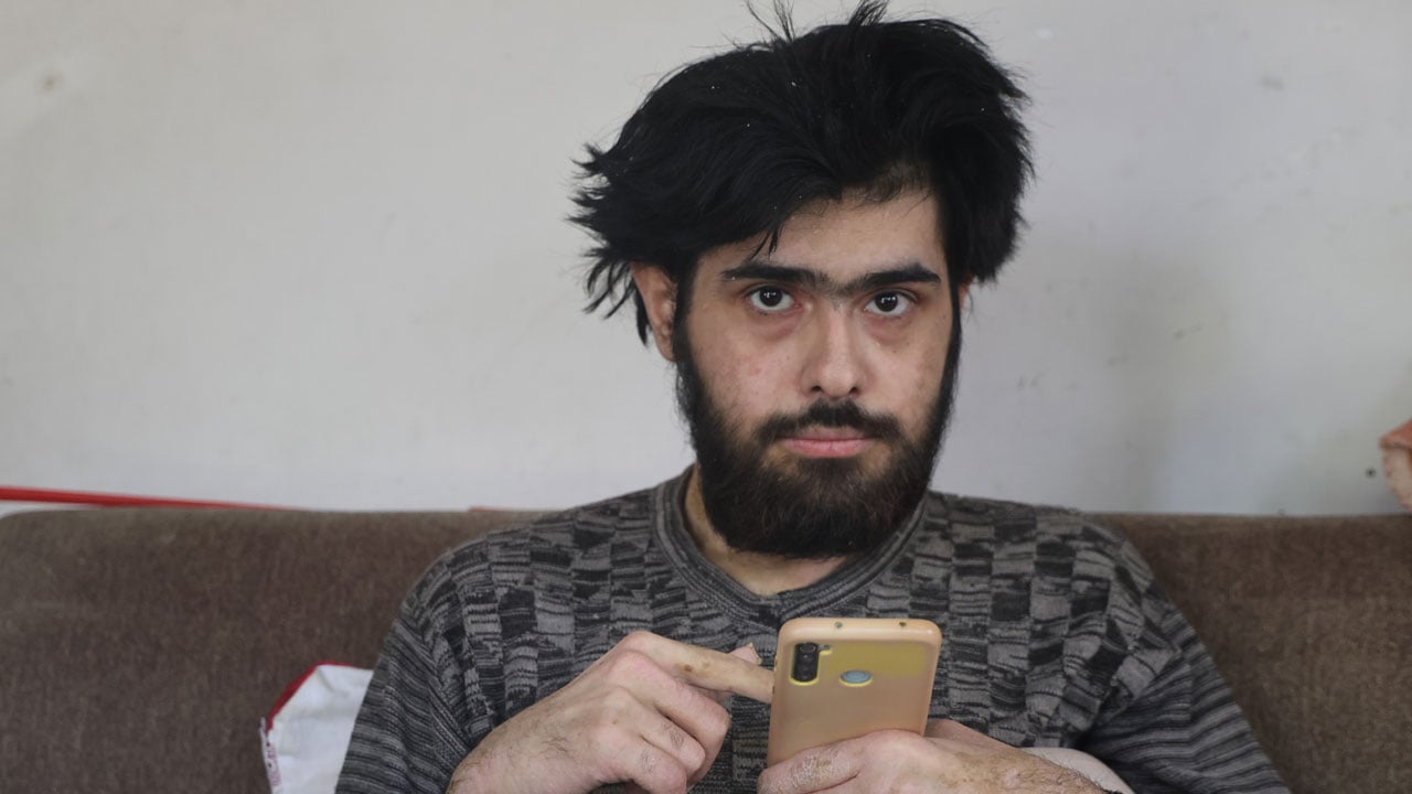 Foto - Hatay’da yürek burkan hikaye! 3 yıldır evden çıkmıyor sadece telefonla yaşıyor