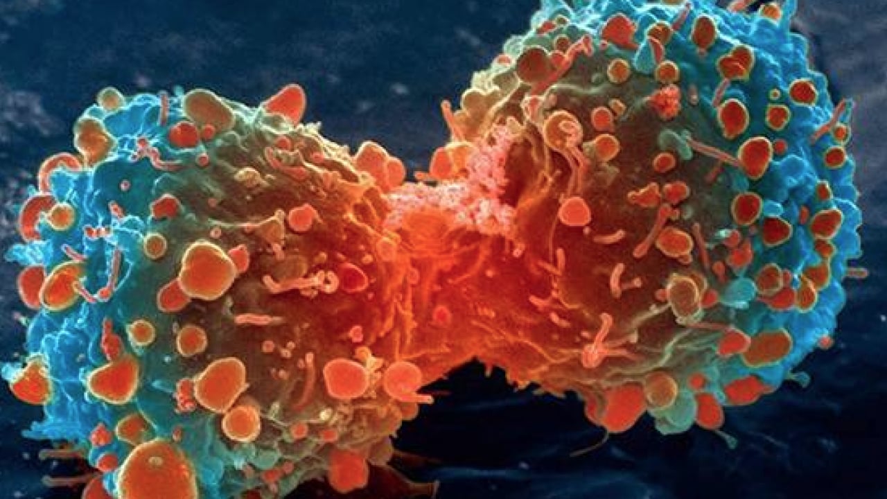 Hayati uyarılar: 'Kanserden korunmak mümkün' dedi ve ekledi...