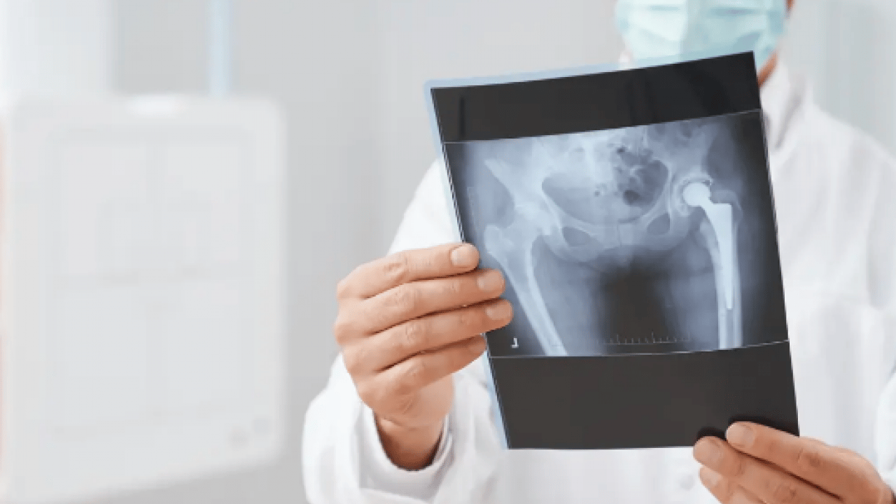 Foto - Hayatınızı çökertmeyin! Bu ağrıyı ciddiye alın yoksa?!? Kemik yapımıyla yıkımı...