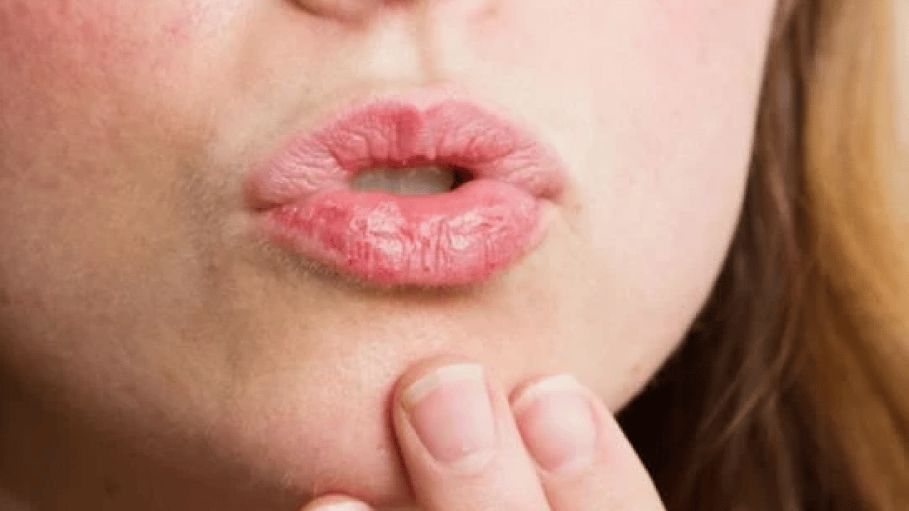 Foto - Hekimden uyarı: Ağız kuruluğu, ciddi bir sistemik hastalığın habercisi olabilir