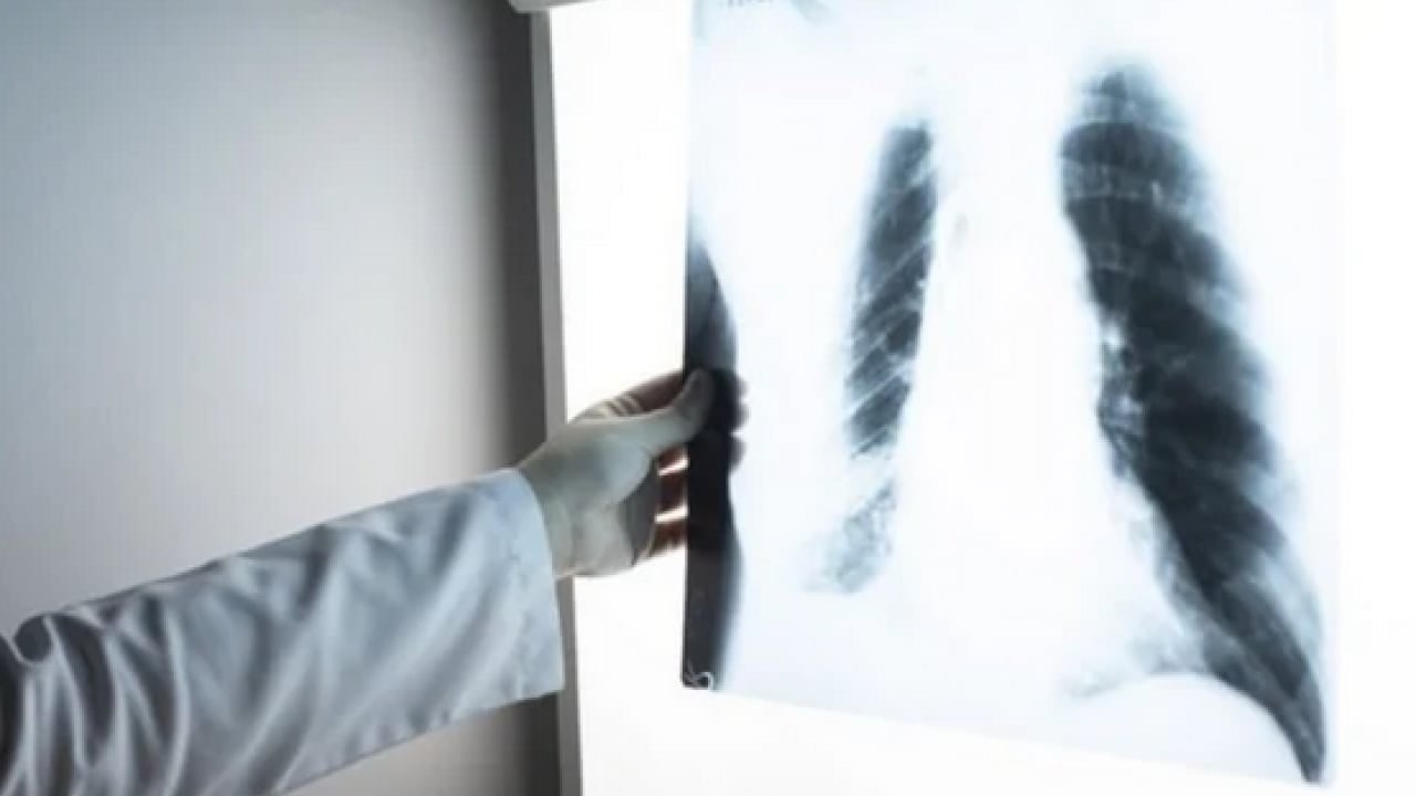 Foto - Hem ruhen, hem fiziken... Derin nefes almaya alışın: İşte faydaları