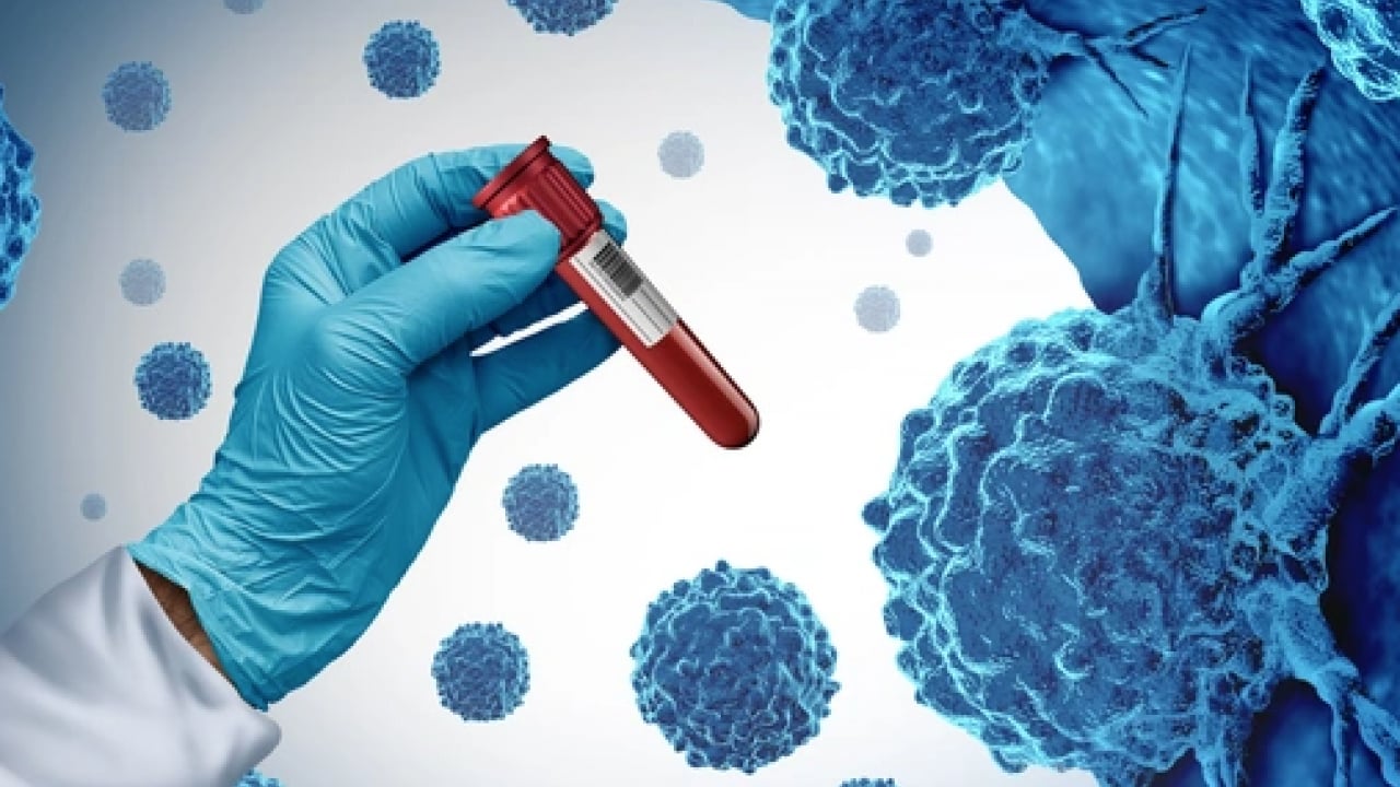 Foto - Hematolojide umut veren yeni dönem! Kemik iliği nakli, hücresel tedaviler ve...