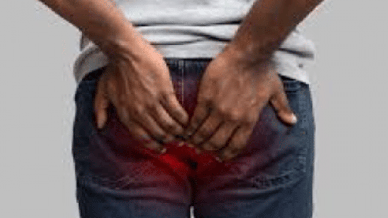 Foto - Hemoroid rahatsızlığı olanlar dikkat! Çok daha korkutucu bir hastalığın habercisi olabilir