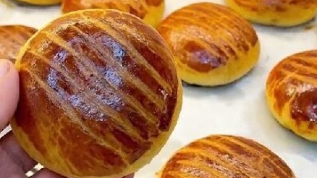 Foto - Her gün poğaça yiyen yandı: En çalışkan organı çürütüyor!