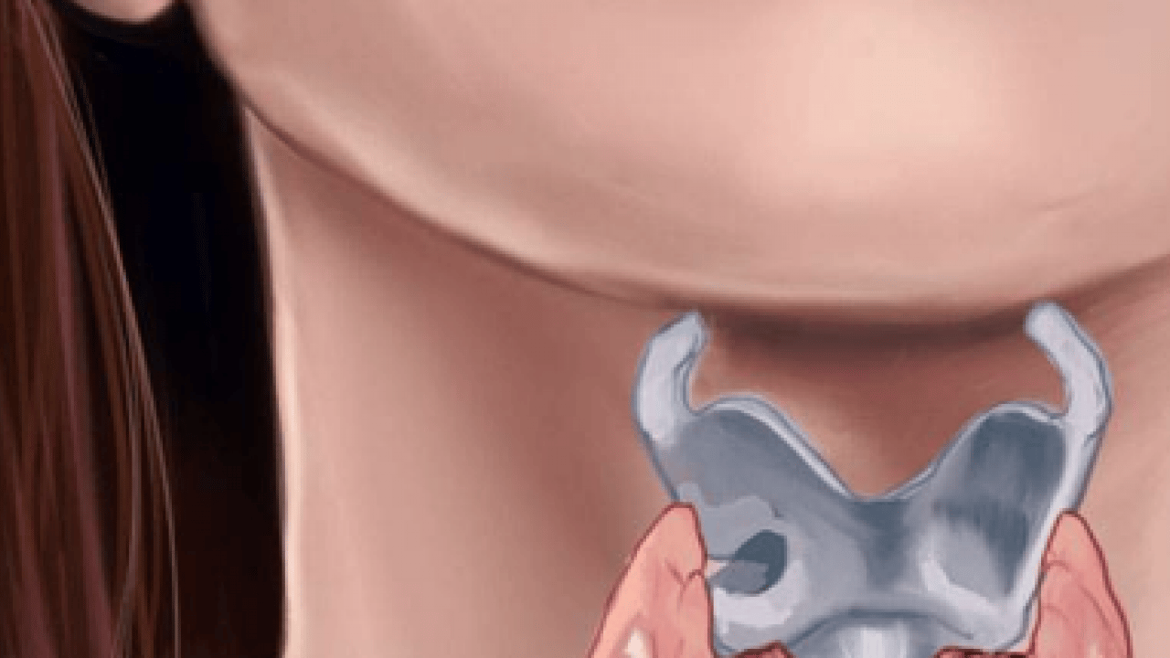 Foto - Her tiroid nodülü ameliyat gerektirmez diyerek açıkladı! Ablasyon işleminin...