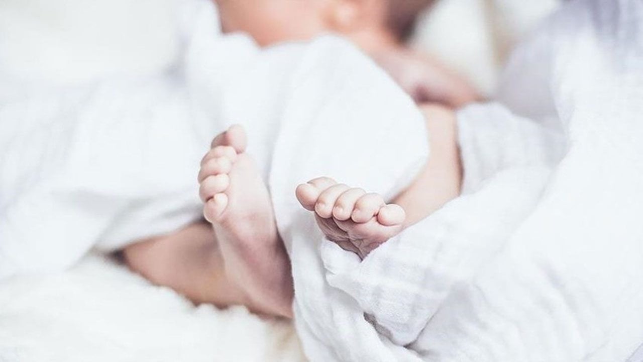 Foto - Herkes bu doğumu konuşuyor! Doktorlar bile şaşkın: 15 milyonda bir görülüyor