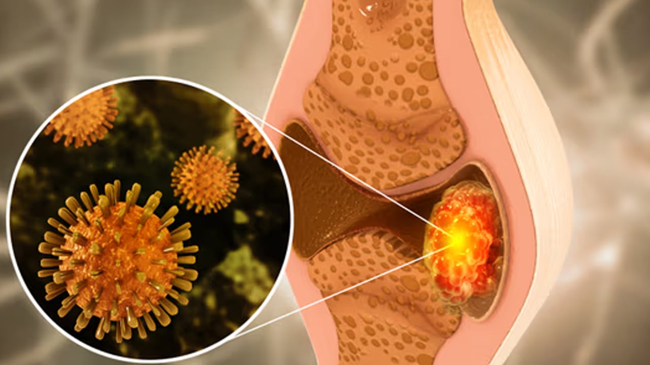  Herkesin korkulu rüyası kanser ile ilgili alkışlanacak hareket: Kanserinin agresif türünün zayıf noktası bulundu