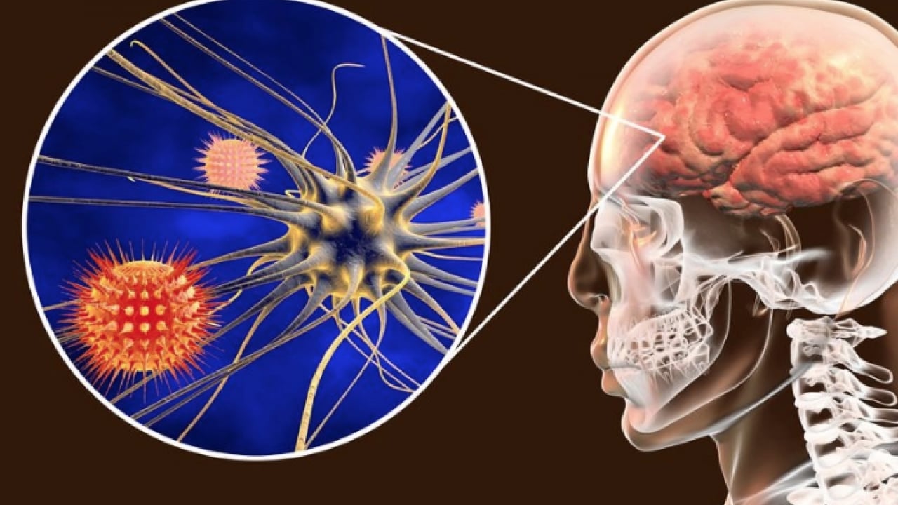 Foto - Hib, pnömokok ve meningokok aşıları... Menenjit belirtileri olan bir çocuk için her dakika kritik...