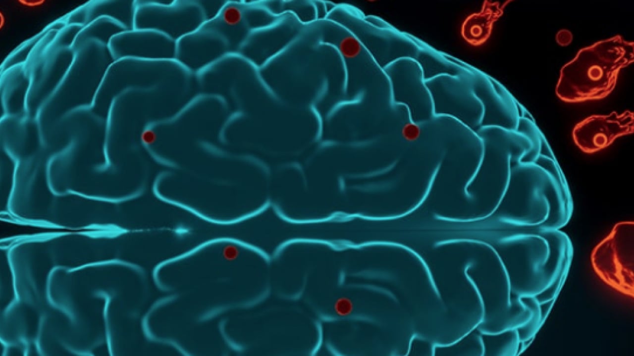 Foto - Hib, pnömokok ve meningokok aşıları... Menenjit belirtileri olan bir çocuk için her dakika kritik...