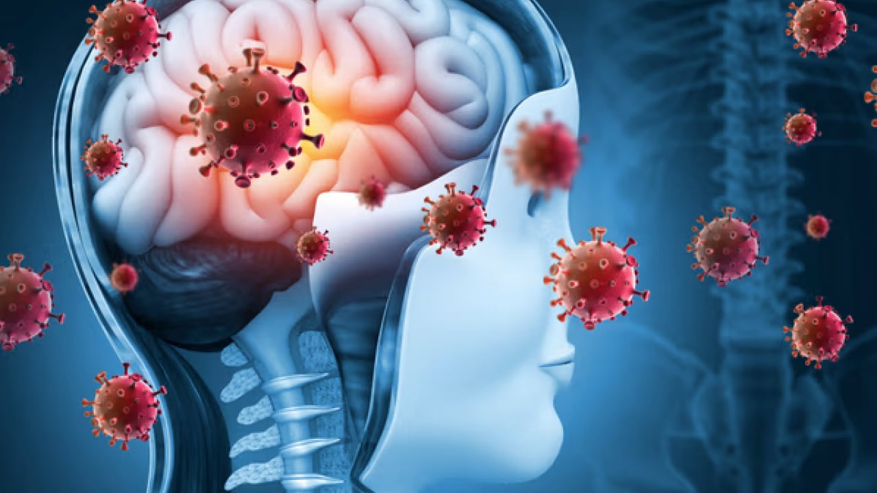 Foto - Hib, pnömokok ve meningokok aşıları... Menenjit belirtileri olan bir çocuk için her dakika kritik...