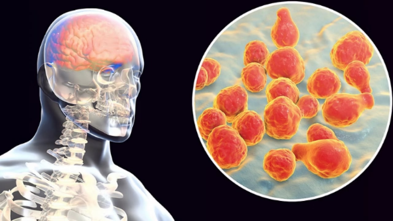 Foto - Hib, pnömokok ve meningokok aşıları... Menenjit belirtileri olan bir çocuk için her dakika kritik...