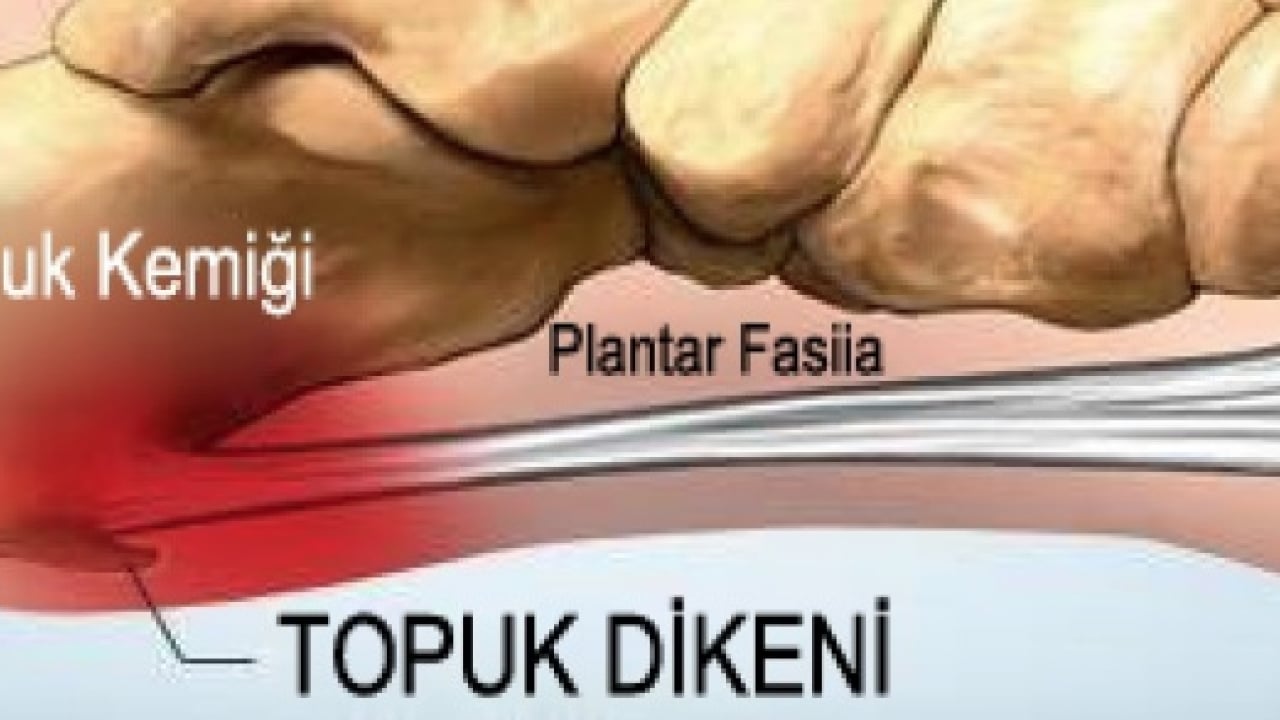 Foto - Hiç hesapta olmayan bu ağrıyı anjiyografik yöntem ile yok edin! Uzmanlar şiddetle tavsiye ediyor...