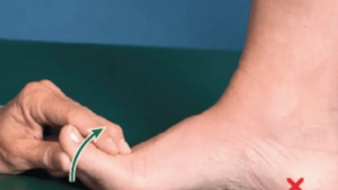 Foto - Hiç hesapta olmayan bu ağrıyı anjiyografik yöntem ile yok edin! Uzmanlar şiddetle tavsiye ediyor...