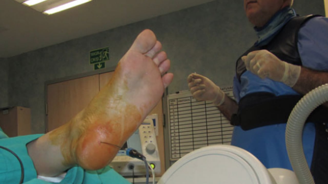 Foto - Hiç hesapta olmayan bu ağrıyı anjiyografik yöntem ile yok edin! Uzmanlar şiddetle tavsiye ediyor...