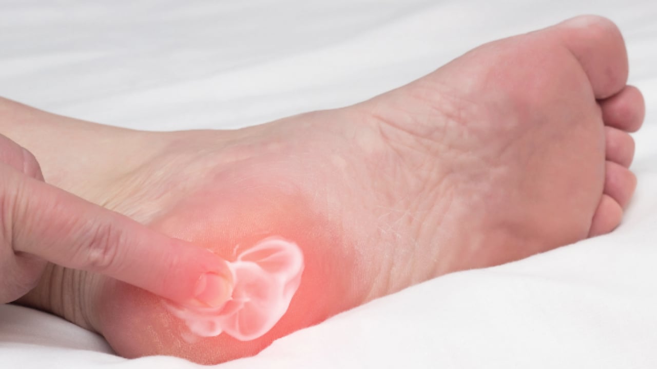 Foto - Hiç hesapta olmayan bu ağrıyı anjiyografik yöntem ile yok edin! Uzmanlar şiddetle tavsiye ediyor...