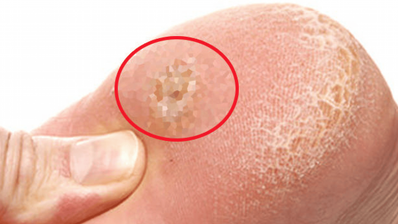 Foto - Hiç hesapta olmayan bu ağrıyı anjiyografik yöntem ile yok edin! Uzmanlar şiddetle tavsiye ediyor...