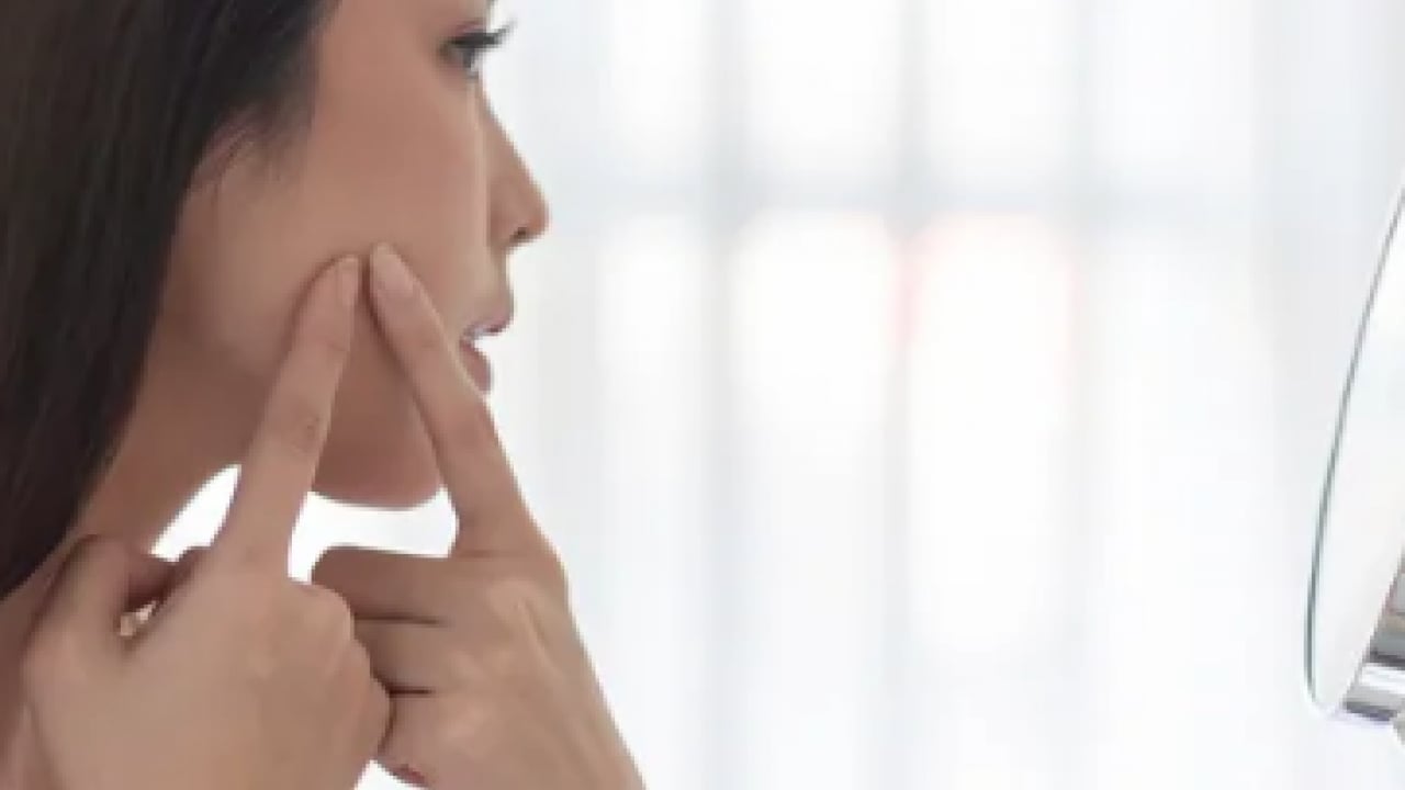 Foto - Hiç hesapta olmayan gelişme olmasın! Bu sivilceleri asla sıkmayın! Masum sanılıyor ama büyük risk