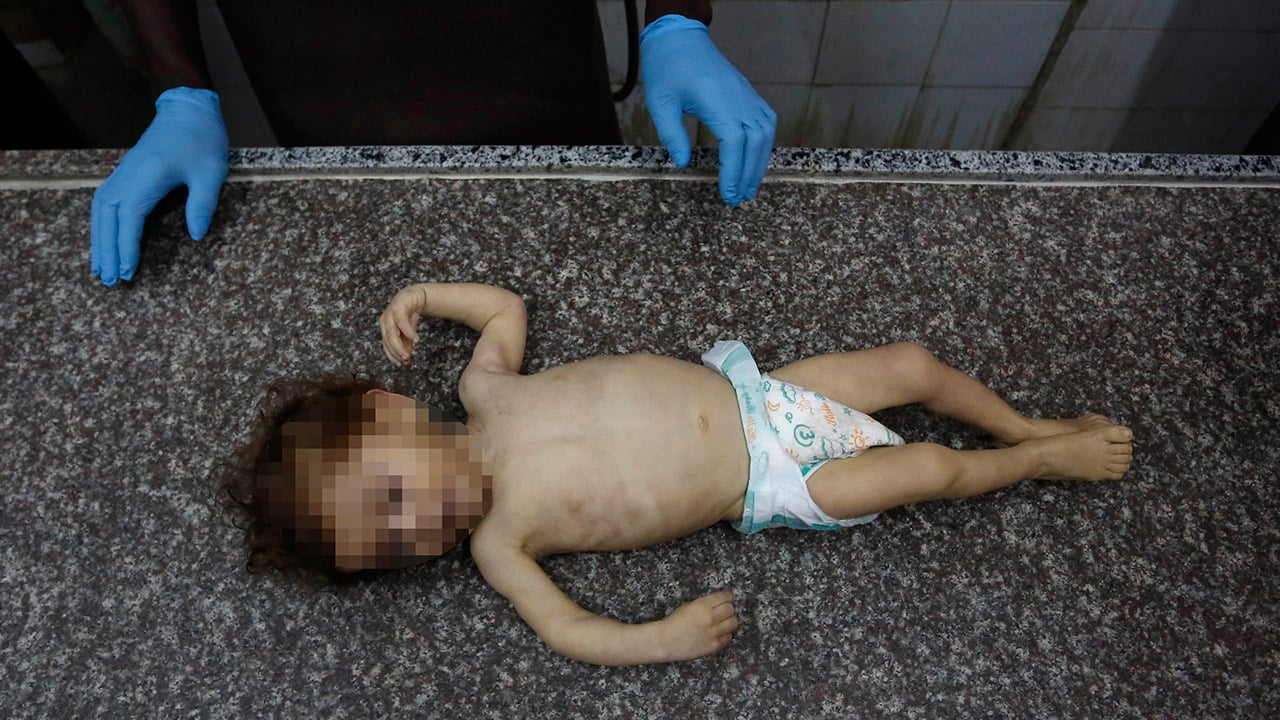 Foto - Hiçbir İslam ülkesi terörist İsrail’in inadını kıramıyor… Gazze’de 1 yaşındaki Muhammed de soğukta hayatını kaybetti