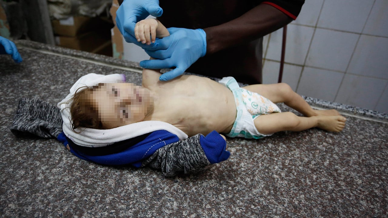 Foto - Hiçbir İslam ülkesi terörist İsrail’in inadını kıramıyor… Gazze’de 1 yaşındaki Muhammed de soğukta hayatını kaybetti