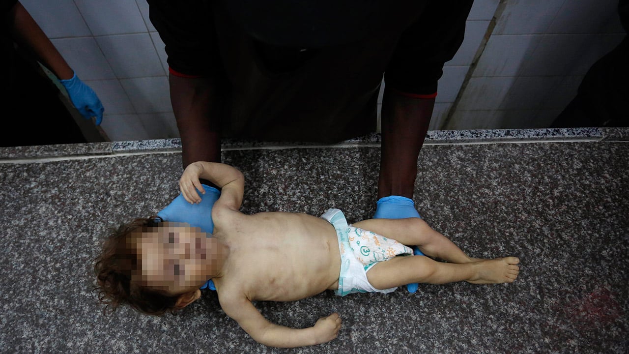 Foto - Hiçbir İslam ülkesi terörist İsrail’in inadını kıramıyor… Gazze’de 1 yaşındaki Muhammed de soğukta hayatını kaybetti