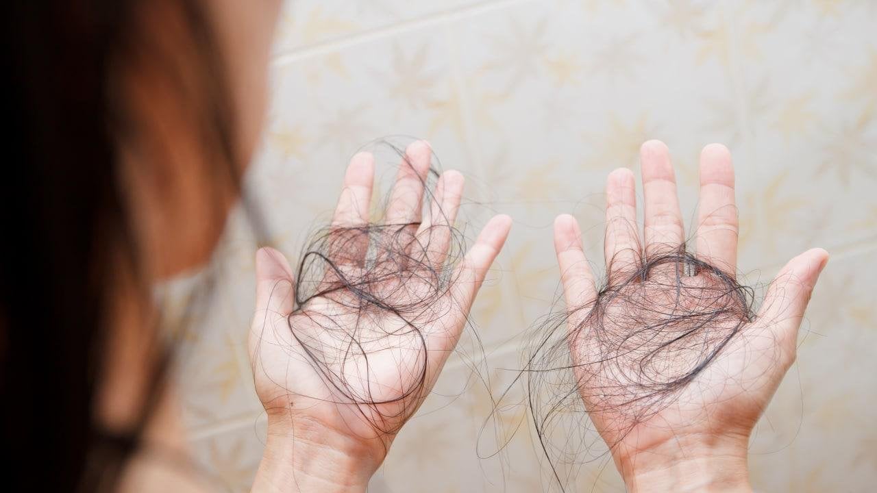 Hint yağı saç dökülmesini bitiren yağ: Dökülen saçlarınızı ayağa kaldıran yol! Evlerde bunu yapan yaşadı