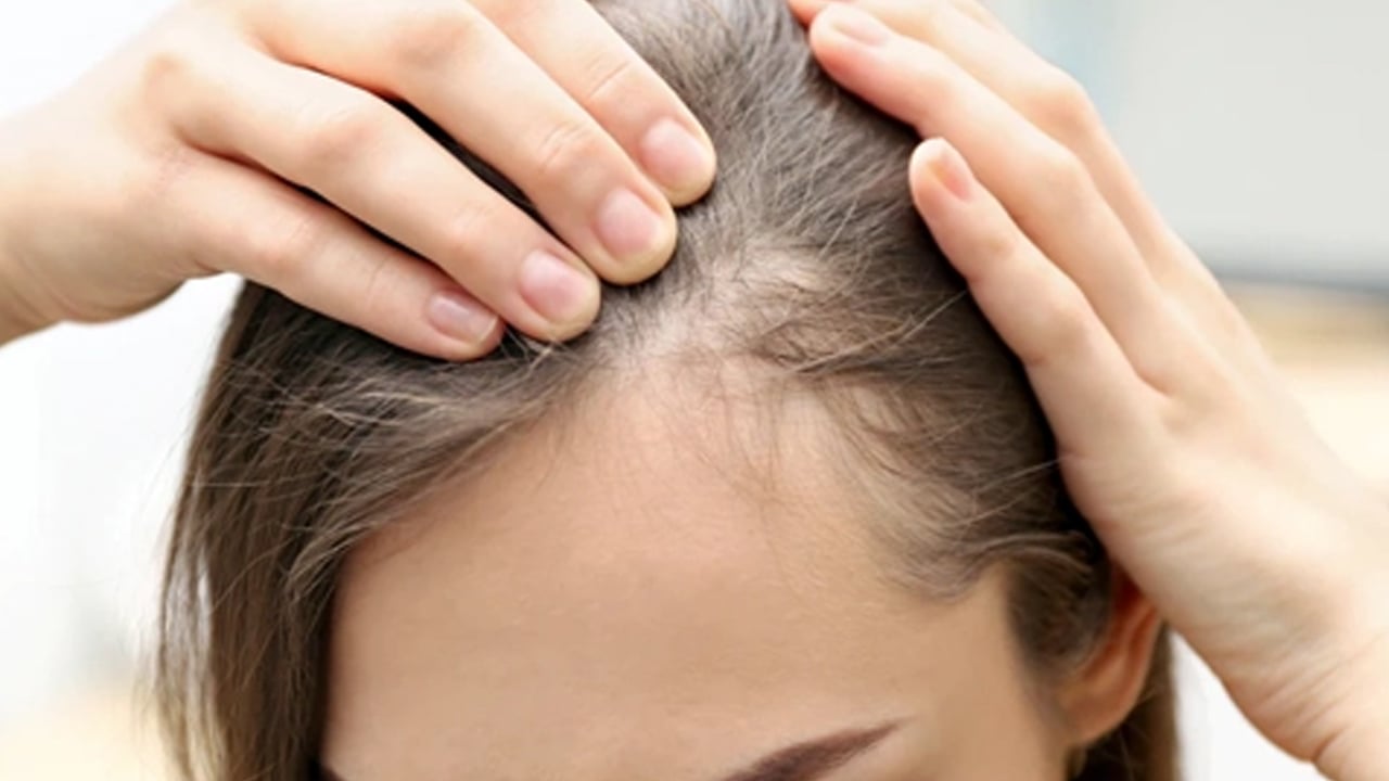 Foto - Hint yağı saç dökülmesini bitiren yağ: Dökülen saçlarınızı ayağa kaldıran yol! Evlerde bunu yapan yaşadı