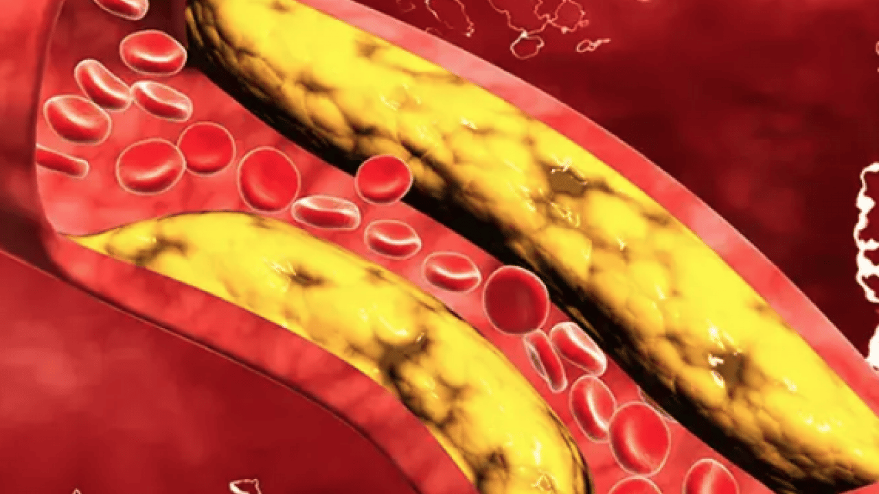 Hipertansiyon, kolesterol ve kalp... Çözünebilir lifler kolesterolü düşürebilir