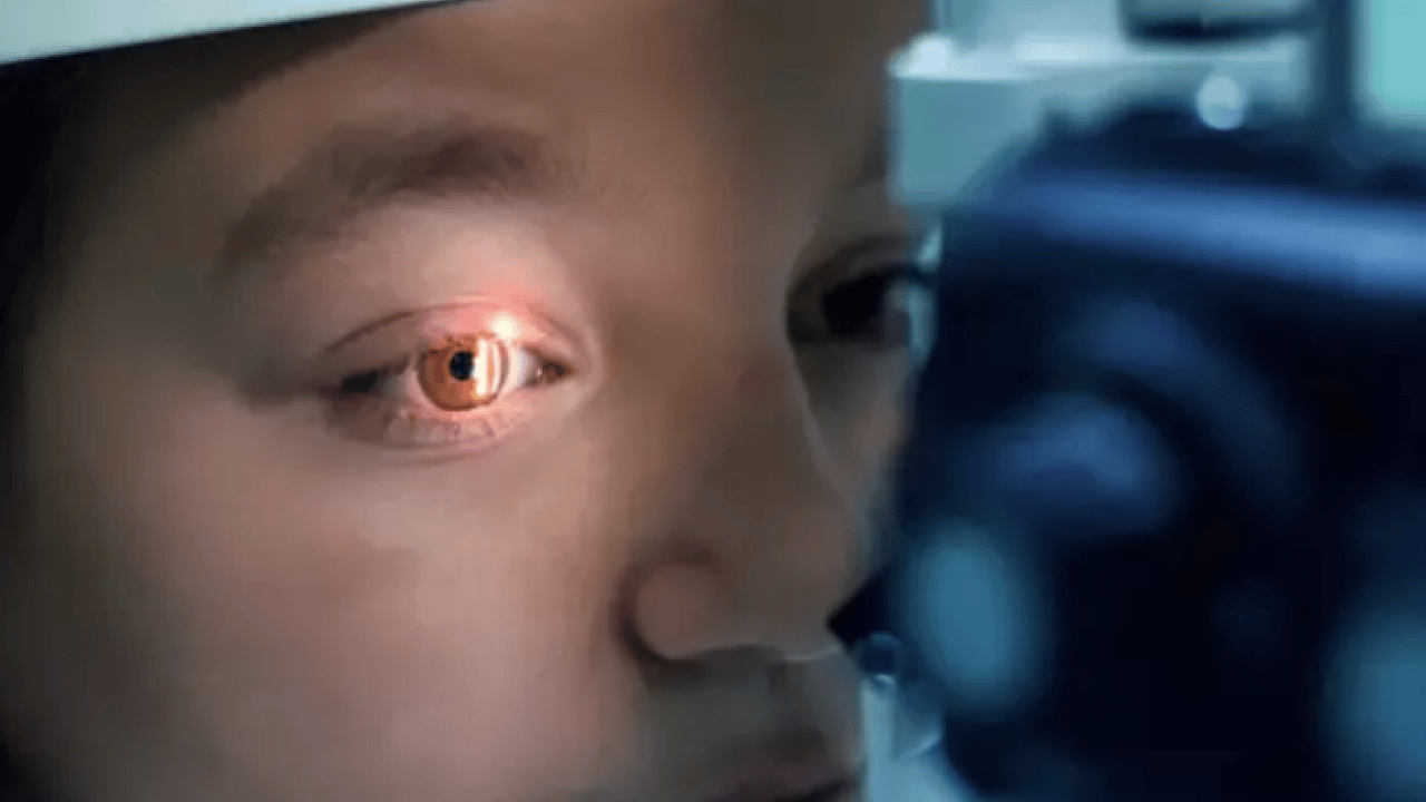 Foto - İbn-i Sina 1000 yıl önce önerdi! Tepsiye koyup sadece 5 dakika ile net sonuçlar alın...