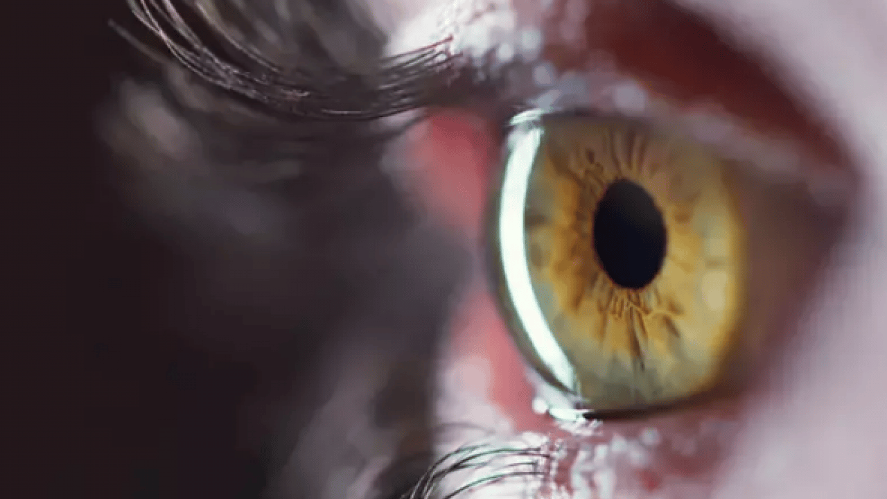 İbn-i Sina 1000 yıl önce önerdi! Tepsiye koyup sadece 5 dakika ile net sonuçlar alın...